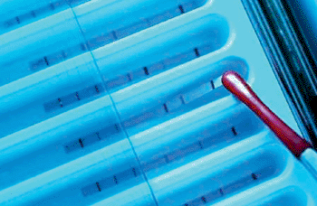 Imagen: El análisis de sonda de línea GenoType MTBDR, diseñado para detectar la tuberculosis resistente a los medicamentos (Fotografía cortesía de Hain Lifescience).